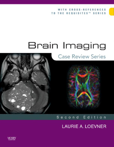 Brain Imaging: Case Review Series, Second Edition