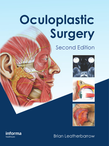 Oculoplastic Surgery, Second Edition