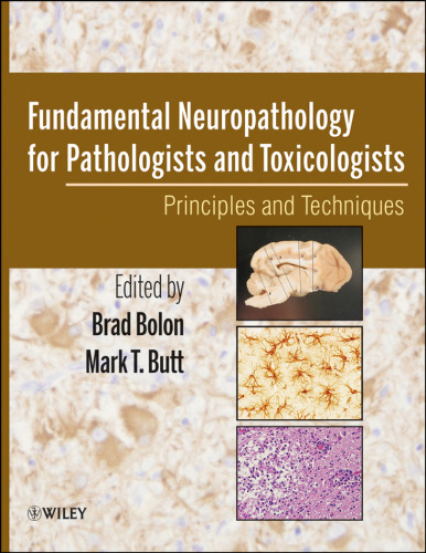 Fundamental Neuropathology for Pathologists and Toxicologists: Principles and Techniques  