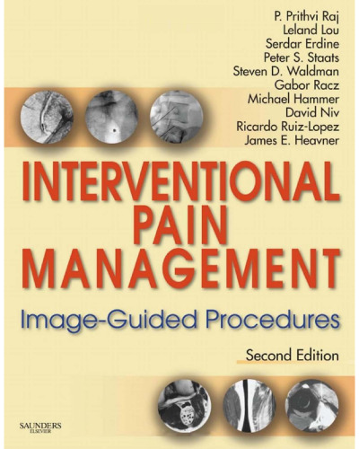 Interventional Pain Management: Image-Guided Procedures, Second Edition  