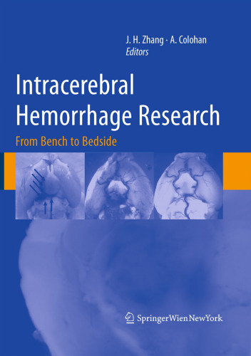Intracerebral Hemorrhage Research: From Bench to Bedside