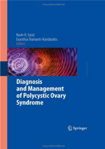 Diagnosis and Management of Polycystic Ovary Syndrome