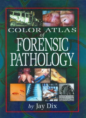 Color Atlas of Forensic Pathology