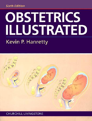 Obstetrics Illustrated 