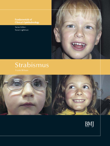 Strabismus. Fundamentals of Clinical Opthalmology