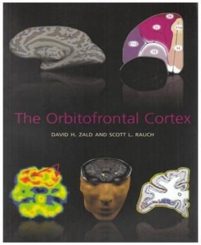 The Orbitofrontal Cortex