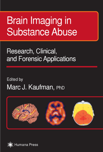 Brain Imaging in Substance Abuse. Research, Clinical and Forensic Applns