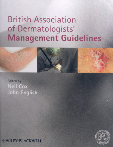 British Association of Dermatologists Management Guidelines