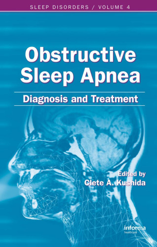 Obstructive Sleep Apnea. Diagnosis and Treatment