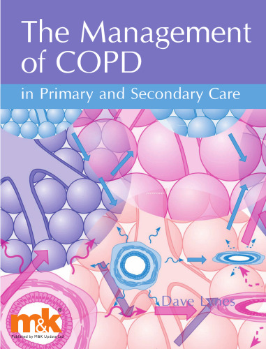 The Management of COPD