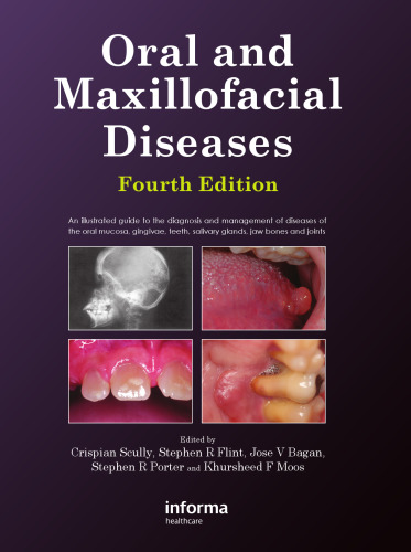 Oral and Maxillofacial Diseases, 4th Editon