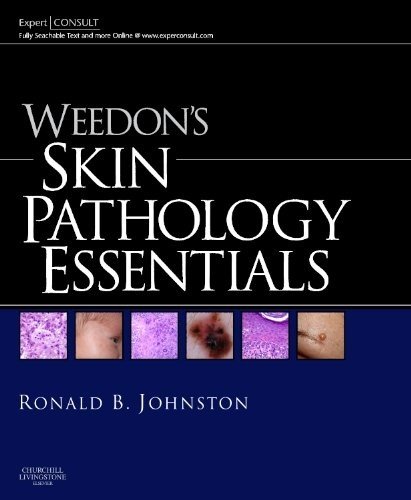 Weedon's Skin Pathology Essentials: Expert Consult: Online and Print