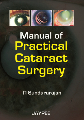 Manual of Practical Cataract Surgery
