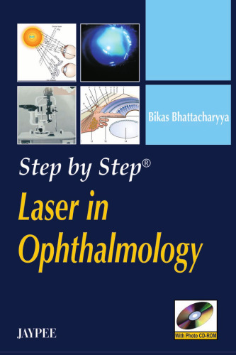 Step by Step Laser in Ophthalmology