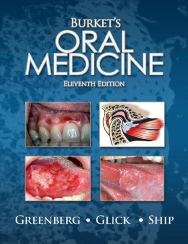 Burket's Oral Medicine, 11th Edition