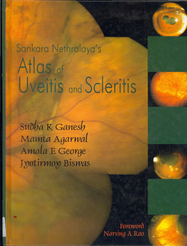 Atlas of Uvetis and Scleritis