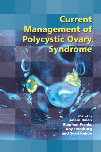Current Management of Polycystic Ovary Syndrome