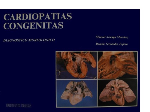 Cardiopatías congénitas: diagnóstico morfológico
