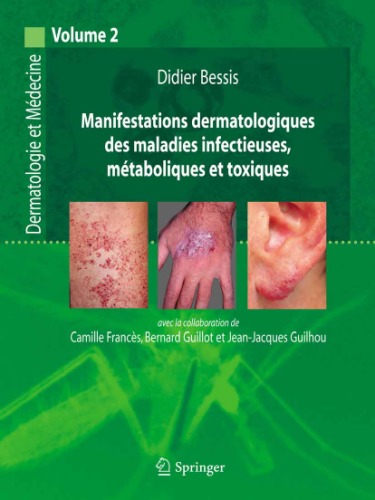 Manifestations dermatologiques des maladies infectieuses metaboliques et toxiques