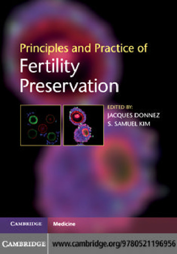 Principles and Practice of Fertility Preservation
