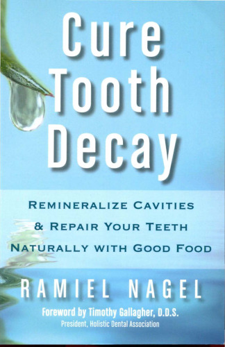 Cure Tooth Decay: Heal and Prevent Cavities with Nutrition, 2nd Edition