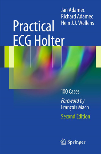 Practical ECG Holter: 100 Cases