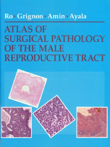 Atlas of surgical pathology of the male reproductive tract