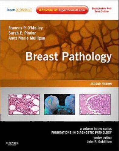 Breast Pathology: A Volume in the Foundations in Diagnostic Pathology Series (Second Edition)