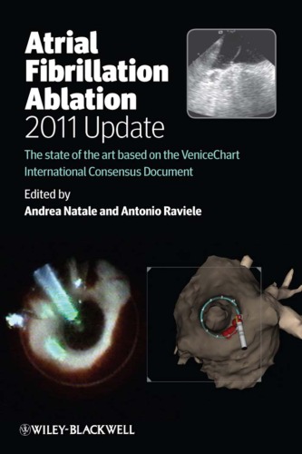 Atrial Fibrillation Ablation, 2011 Update: The State of the Art Based on the VeniceChart International Consensus Document