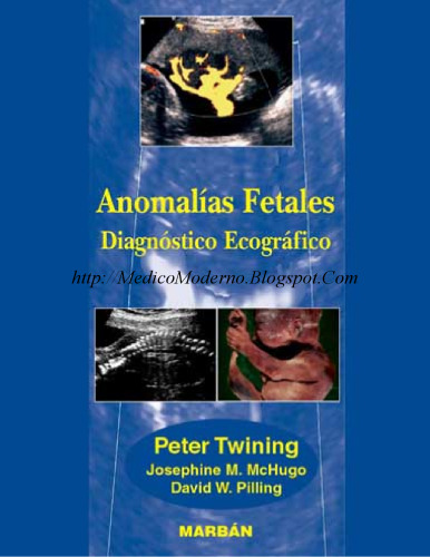 Anomalías fetales: diagnóstico ecográfico