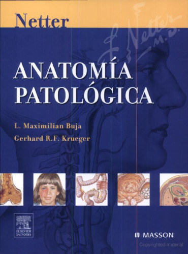 Netter.Anatomia Patologica