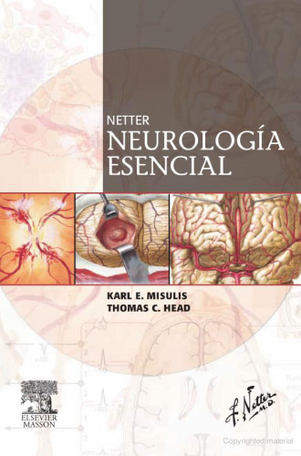 Netter. Neurología esencial