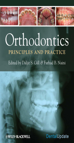 Orthodontics: Principles and Practice (Dental Update)
