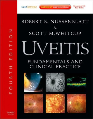 Uveitis: Fundamentals and Clinical Practice: Expert Consult - Online and Print, Fourth Edition