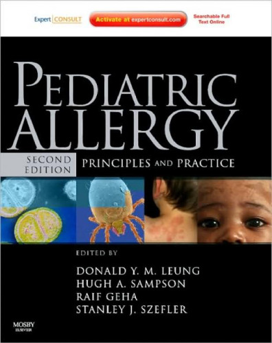 Pediatric Allergy: Principles and Practice: Expert Consult (Leung, Pediatric Allergy), Second Edition