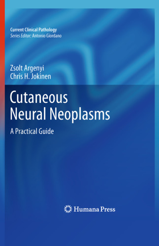 Cutaneous Neural Neoplasms: A Practical Guide