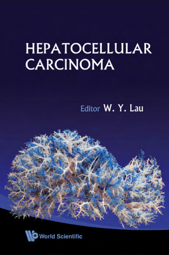 Hepatocellular Carcinoma