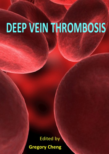 Deep Vein Thrombosis