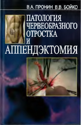Патология червеобразного отростка и аппендэктомия