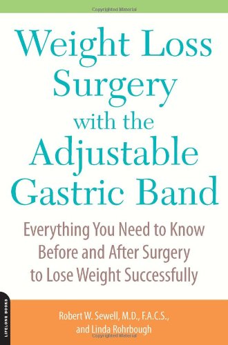 Weight Loss Surgery with the Adjustable Gastric Band: Everything You Need to Know Before and After Surgery to Lose Weight Successfully