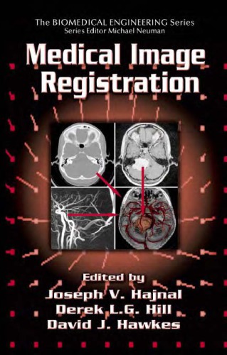 Medical image registration