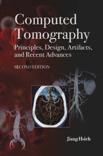 Computed tomography. Principles, design, artifacts, and recent advances