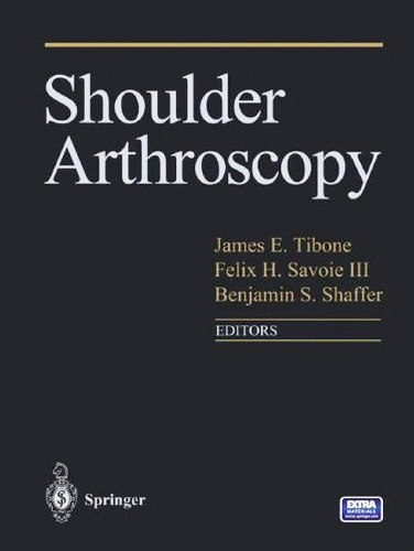 Shoulder Arthroscopy