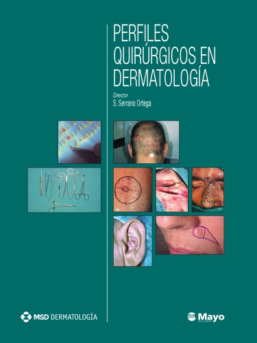 Perfiles quirúrgicos en dermatología