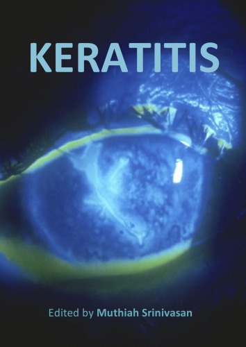 Keratitis