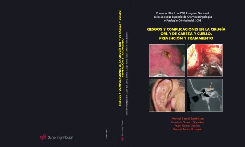 Riesgos y complicaciones en la cirugía ORL y de cabeza y cuello : prevención y tratamiento : ponencia oficial del LIX Congreso Nacional de la Sociedad Española de Otorrinolaringologia y Patología Cérvico-facial, 2008