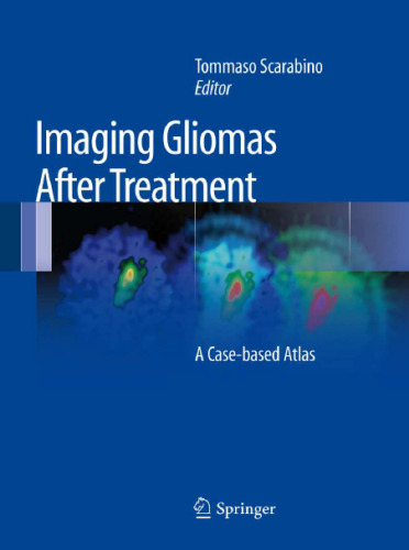 Imaging Gliomas After Treatment: A Case-based Atlas