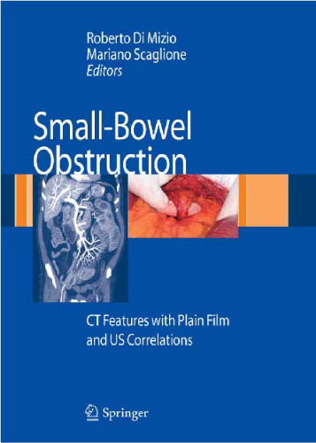 Small-Bowel Obstruction: CT Features with Plain Film and US correlations