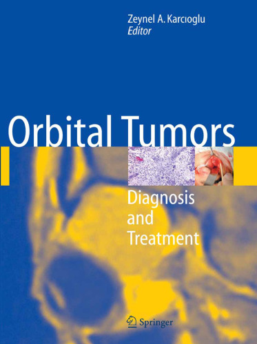 Orbital Tumors: Diagnosis and Treatment