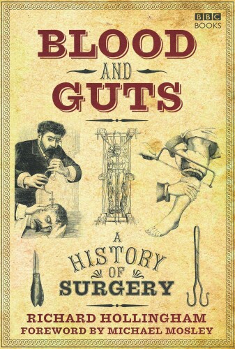 Blood and guts: A history of surgery